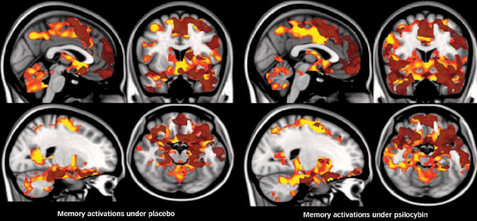 hyperconnected brain mushrooms -Wat zijn psychedelische hallucinaties?