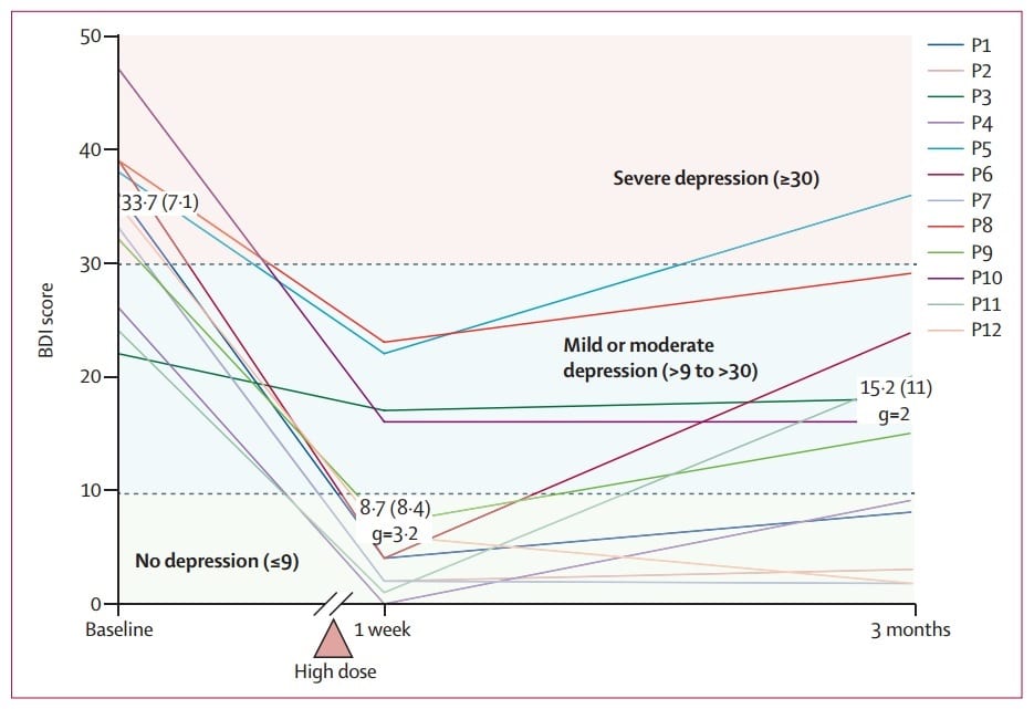 psilocybin treatment resistant depression -Depressie behandeling met psilocybine