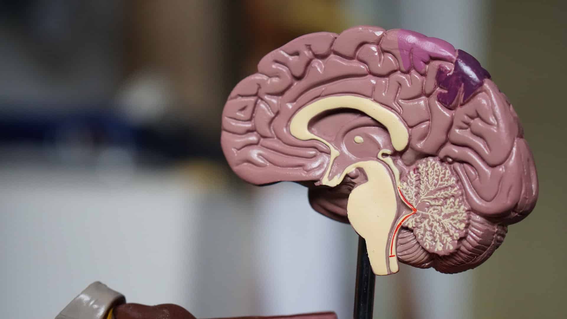 https://triptherapie.nl/wp-content/uploads/2023/01/Brain-psilocybin.jpg
